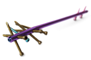 CHARFIX2 humeral nail