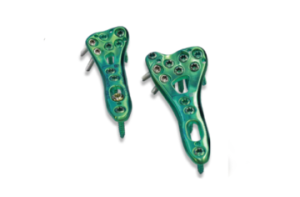 4,0ChLP radius volar plates