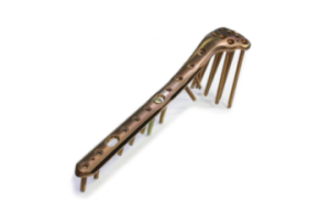 5,0ChLP proximal lateral tibia plate 3.7202/3.7203