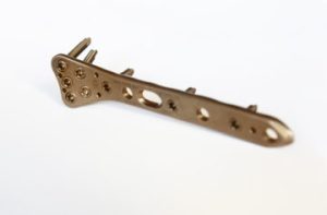 5.0ChLP radius volar plate