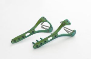 4.0ChLP dorsal-radial plates