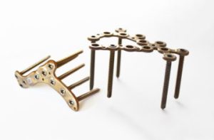 5.0ChLP calcaneal plates