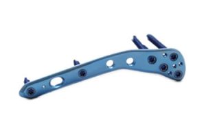 7.0ChLP condylar tibial plate