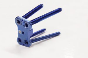 7.0ChLP distance tibial plate