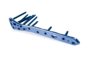 7.0ChLP condylar femoral plate