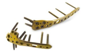 5.0ChLP distal humerus plates