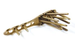 5.0ChLP humerus plate