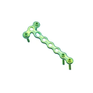 1.5mm Mini Condylar Locking Plate