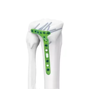 Distal Lateral Tibial Locking Plate-II